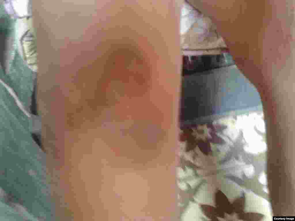 Agresión a La Dama de Blanco Hortensia Alfonso Vega