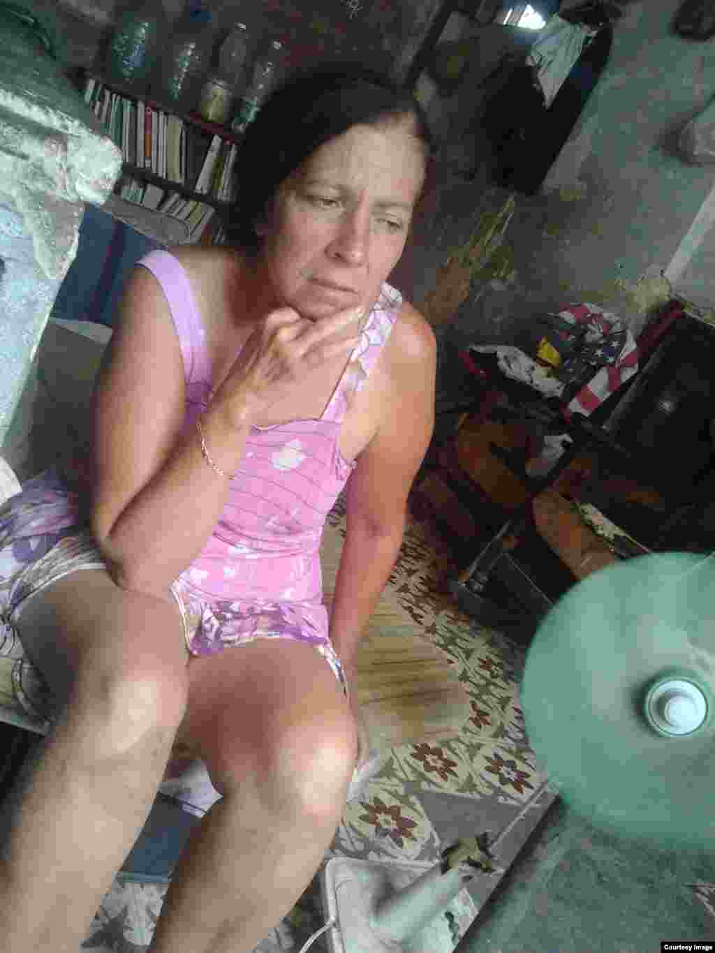 La Dama de Blanco Hortensia Alfonso Vega, de 50 años, todavía se recupera de una operación realizada el 27 de marzo por un cáncer de colon. 