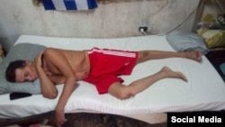 Guillermo del Sol en su día 33 en huelga de hambre.