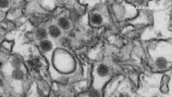 Primer caso de Zika por contagio sexual Primer caso de Zika por contagio sexual