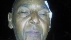 Niegan certificado de lesiones a opositor golpeado por la policía Niegan certificado de lesiones a opositor golpeado por la policía