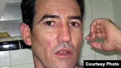 Calixto Ramón Martínez