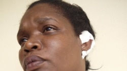 Habala la dama de blanco Aliuska Gómez, multada en varias ocasiones por ejercer su derecho a la libre expresión. Habala la dama de blanco Aliuska Gómez, multada en varias ocasiones por ejercer su derecho a la libre expresión.