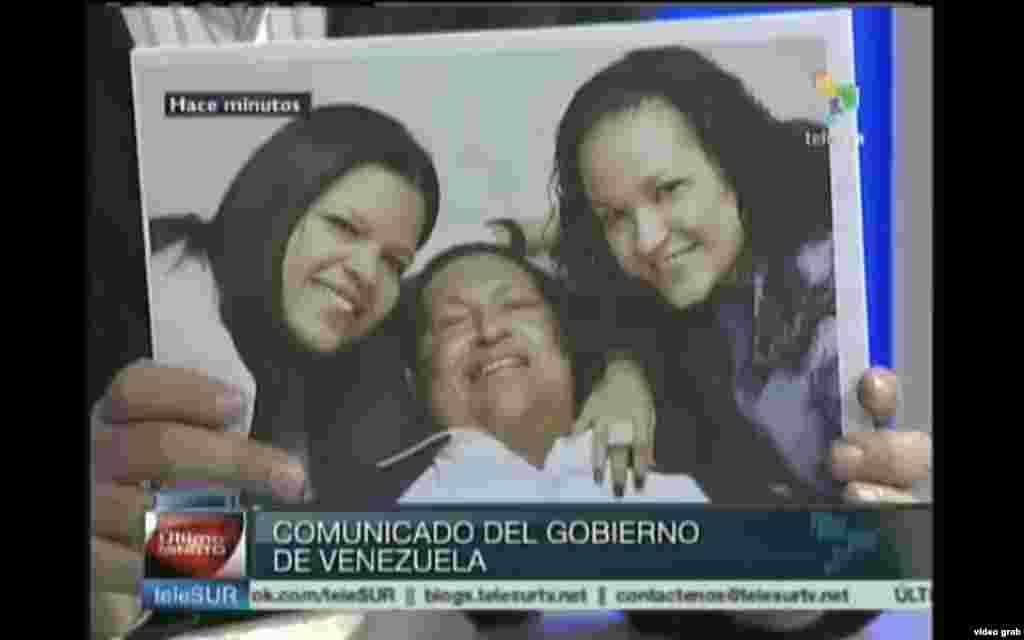 El presidente venezolano, Hugo Chávez, sigue con problemas respiratorios inherentes a la operación por un cáncer que le fue practicada hace más de dos meses en Cuba.