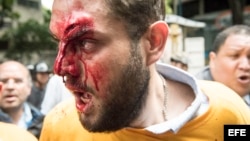 Diputado del partido opositor Primero Justicia, Juan Requesens herido por presuntas personas armadas durante protesta por la "restitución del orden constitucional" en el país.